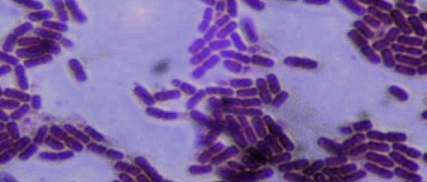 Bacterial microscopy sample