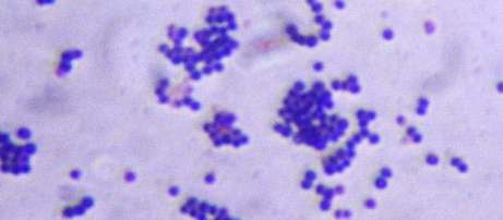 Bacterial microscopy sample